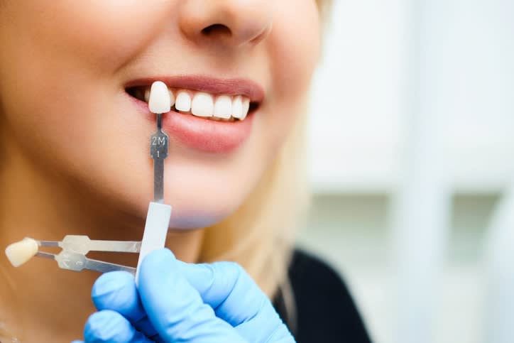 Teeth Whitening, Edmonton Dentist